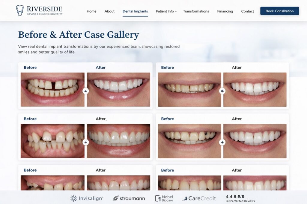 Dental implant before and after gallery page showing patient smile transformations with side-by-side comparison images and clean website layout