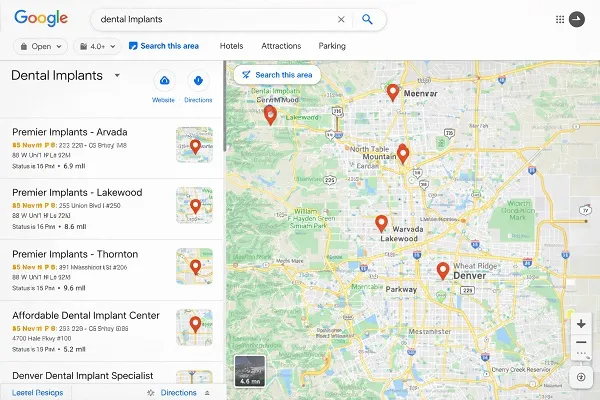 Google Maps Denver dental implants search results showing multiple implant dentists across Denver, Arvada, and Lakewood with map pins and local listings