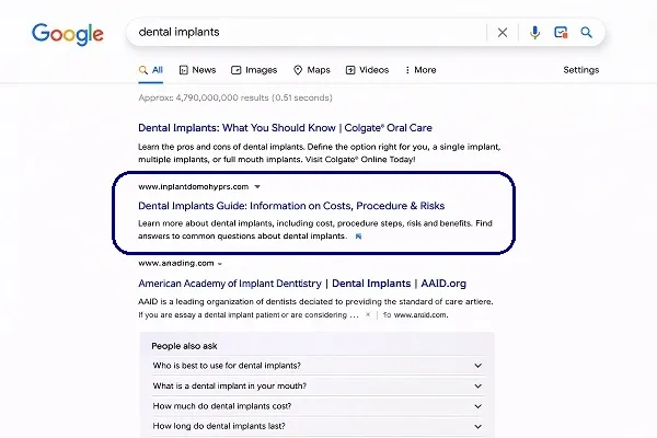 Google search results for dental implants showing organic SEO rankings and top website listings