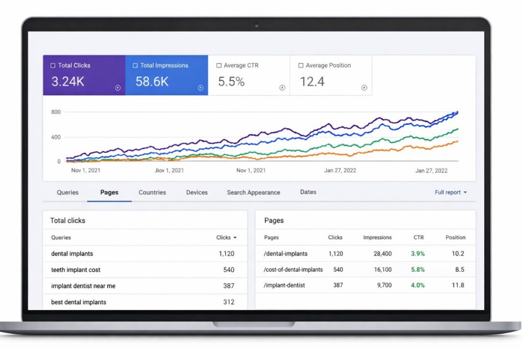 Google Search Console dashboard showing dental implant SEO performance and lead tracking metrics