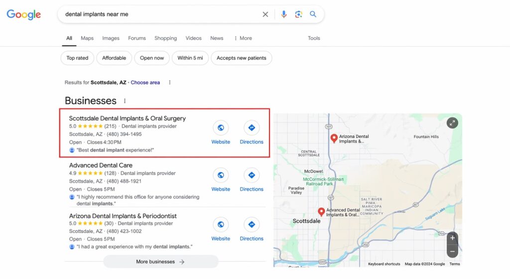 Dental implant company ranking on Google search results for high value procedures